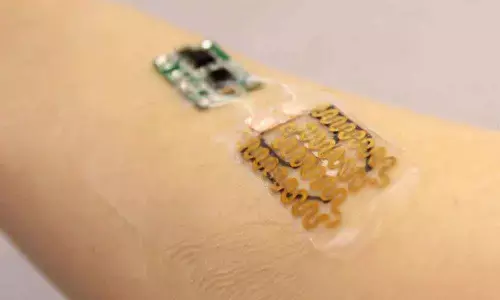 New smart bandage to help heal chronic wounds