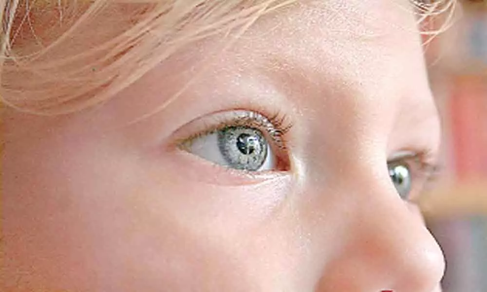 New eye scan may help diagnose autism early in children: Study