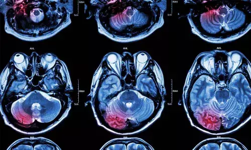 Health issues during 20s likely to develop weaker brain: Study