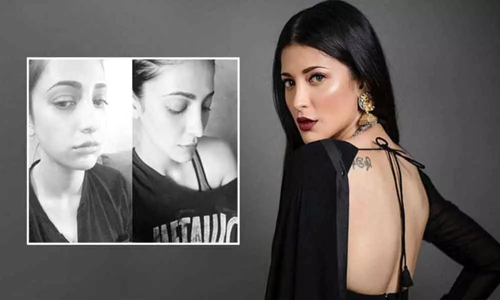 Shruti Hassan Opens Up On Her Plastic Surgery Rumours