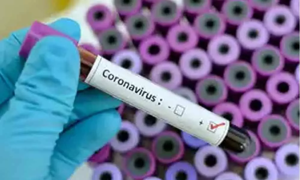 Secunderabad: Alert due to coronavirus in Mahindra Hills