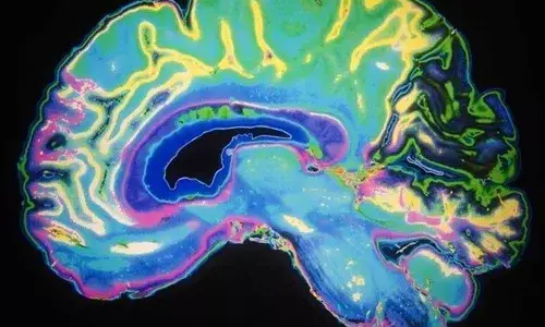 Rejuvenating immune cells support  brain repair after injury