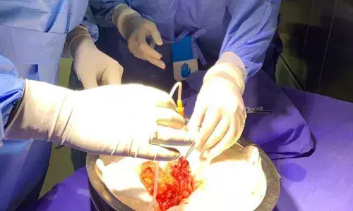 Ongole: First kidney transplant performed in district