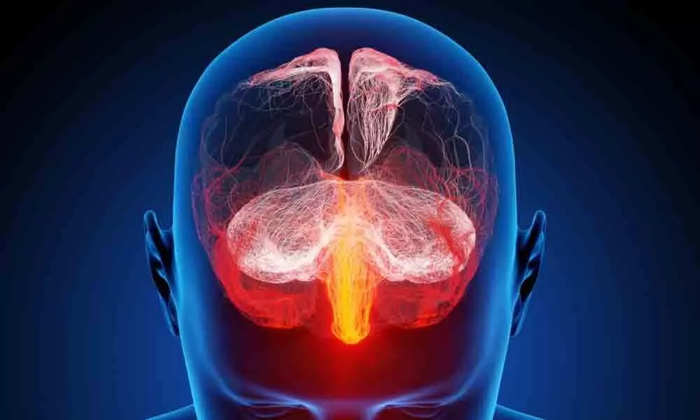 Inflammation in the brain linked to several forms of dementia