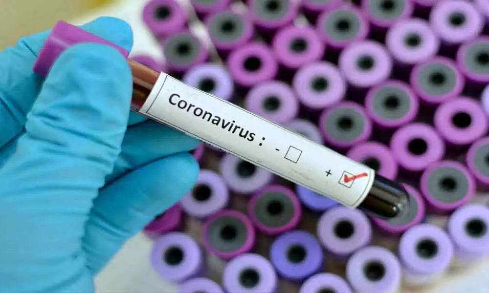 3-year-old tested positive for COVID-19 in Hyderabad, total cases at 41