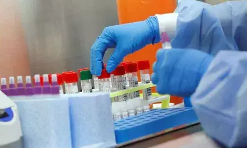 Telangana State chary of using private labs for conducting Covid-19 tests