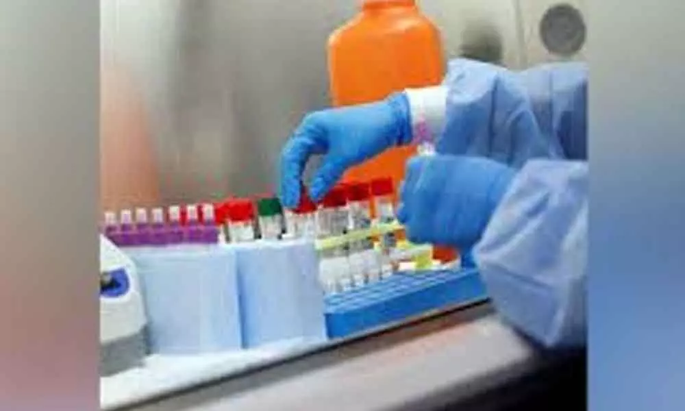 Banaras Hindu University women scientists develop corona testing kit