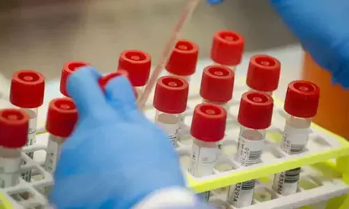 Only exit strategy from coronavirus: Rapidly increase testing