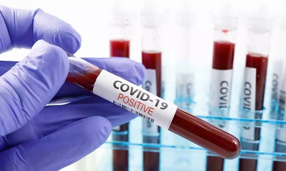 Coronavirus positive cases crosses 400 mark in Andhra Pradesh