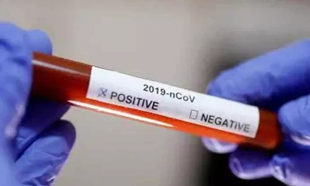 TikTok star who ridiculed coronavirus threat tests positive