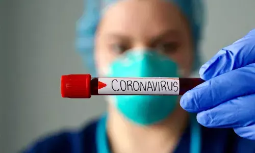 Free COVID-19 Testing Only For EWS, Pvt Labs Can Charge Others, Says Supreme Court