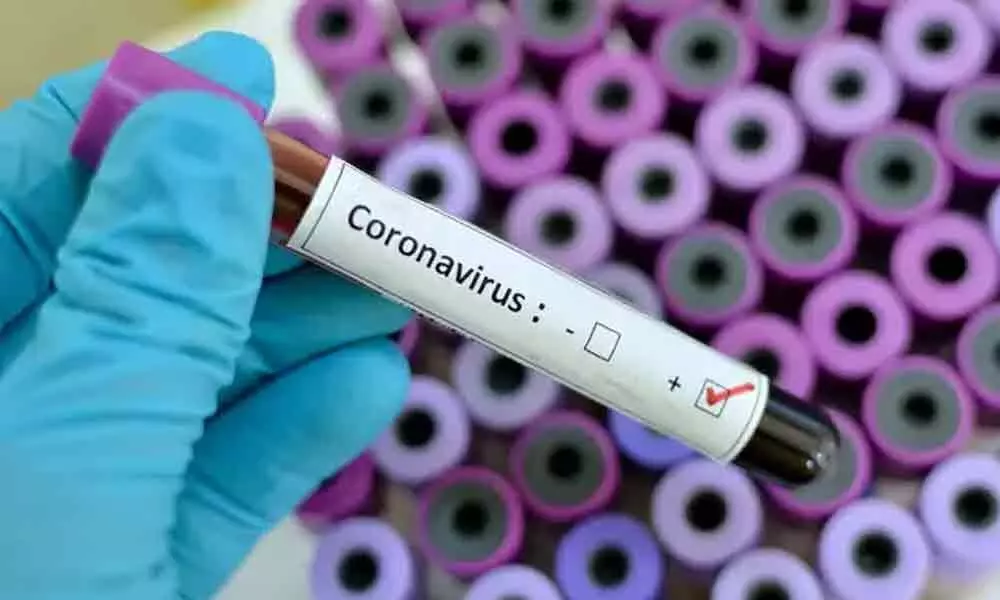 Tension erupts in Guntur after a RMP doctor tests positive for coronavirus