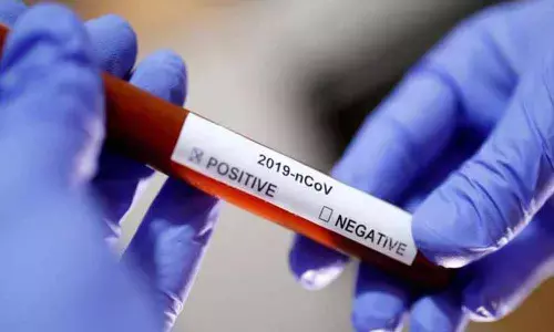 53 journalists test positive for Coronavirus in Mumbai