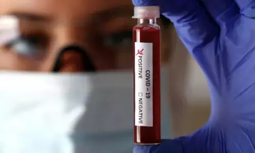 Covid-19 tests in India: The faster, the better