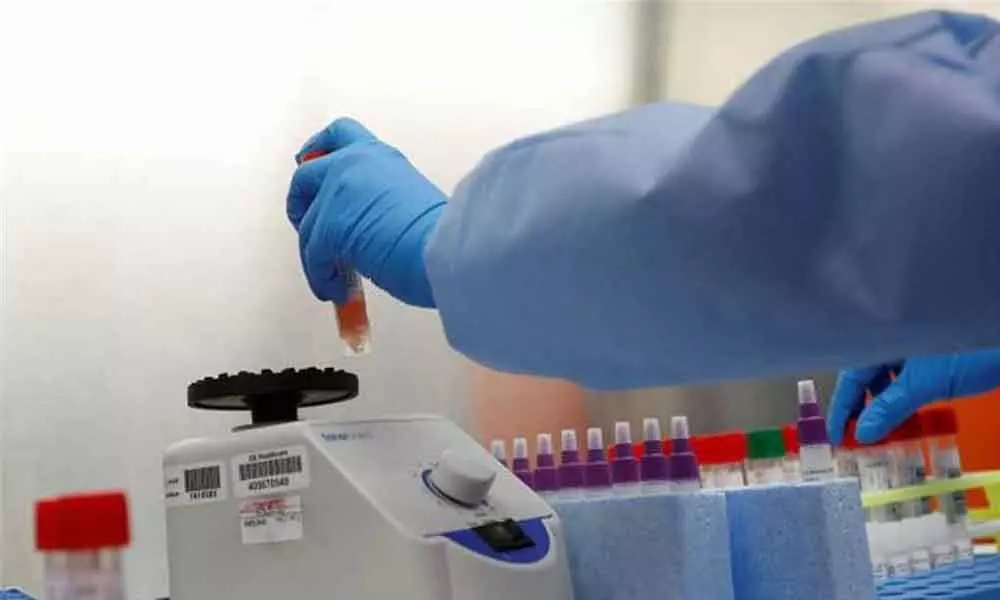 1st test to cost 2,500 in Uttar Pradesh private labs