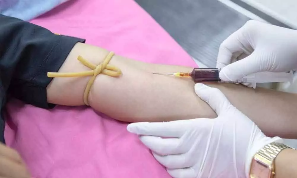 Lucknow doctors donates plasma for treatment of patients