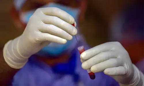 Telangana government says no to coronavirus random rapid testing