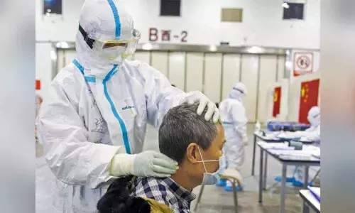 Men are more than twice as likely to die from pandemic