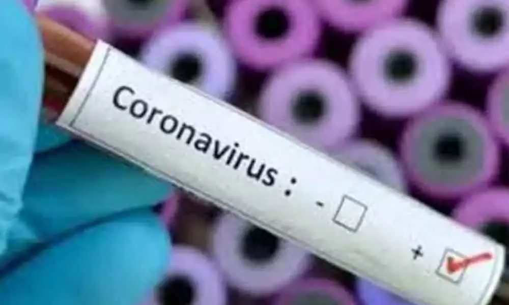 11 new Coronavirus positive cases reported in Karnataka, tally mounts 523