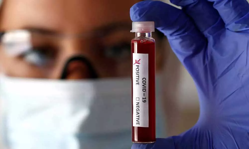 Unani doctor tests positive for coronavirus in Hyderabad