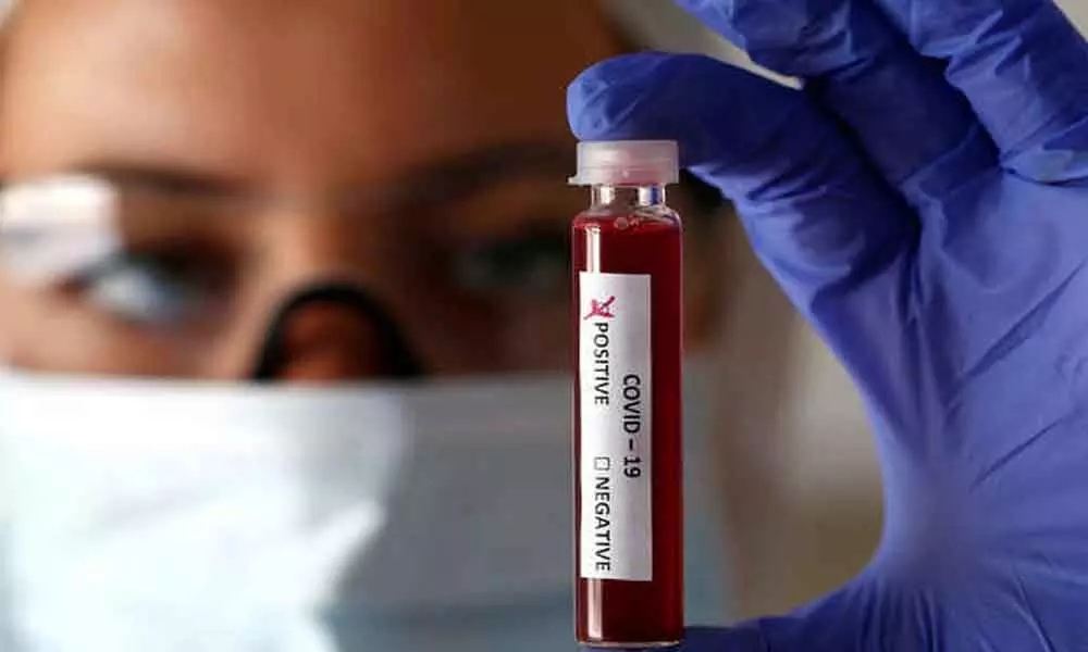 62 new Coronavirus positive cases reported in AP, tally reaches 1525 cases