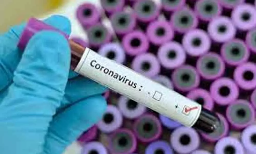 Covid-19 cases rise to 111 in Chittoor district