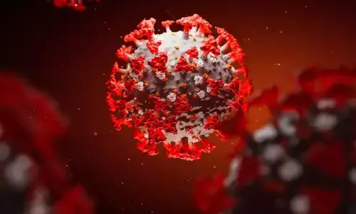 Representational picture