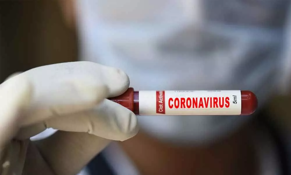 Eight fresh Covid-19 cases reported in Kurnool district