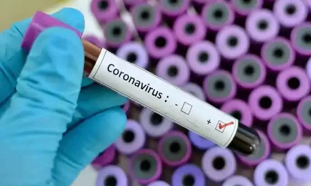 Seven coronavirus positive cases reported in Srikakulam in last 24 hours