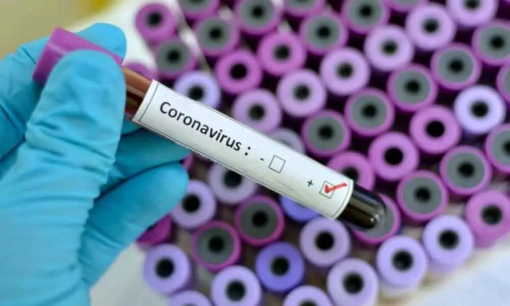 19 contacts of corona victim test positive in East Godavari