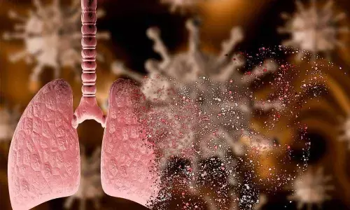 Lungs of dead corona patients show distinctive features: Study