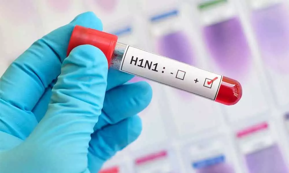 Swine flu kills more than Covid: Expert