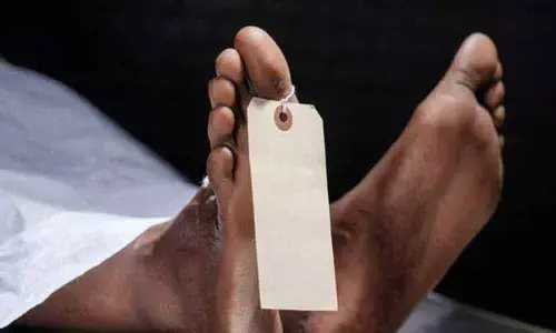 Representational Pic