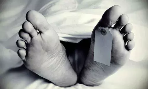 Representational Pic