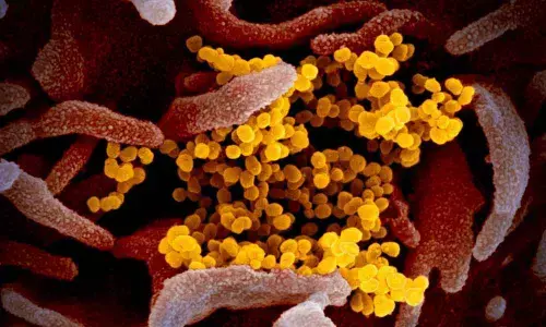 Testing the tests for SARS- CoV-2