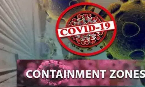 Representational Pic