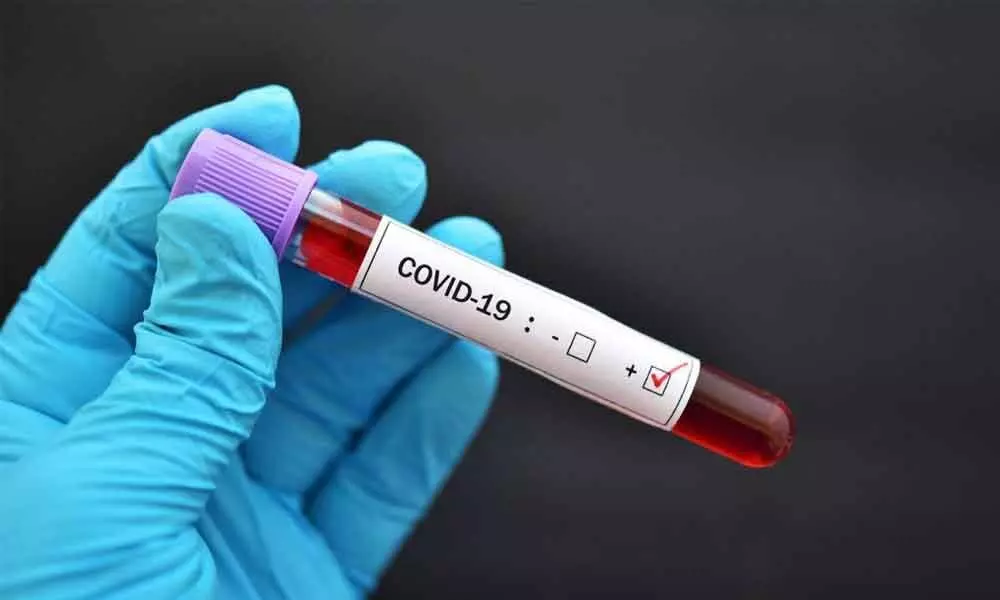 MCX staffer dies, 9 others coronavirus test positive