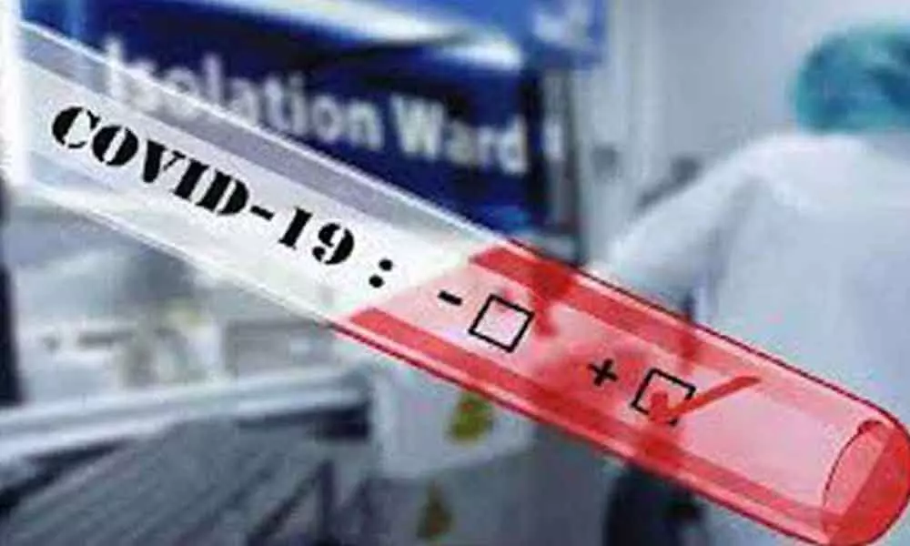 216 new Coronavirus cases reported in Andhra Pradesh