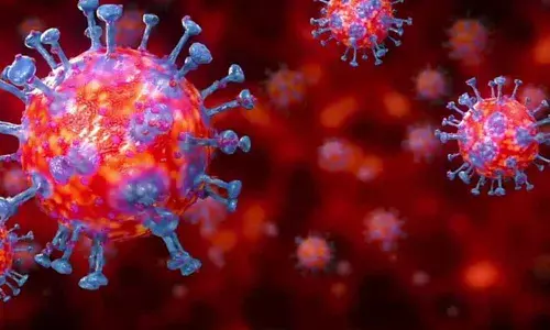 Representational Pic