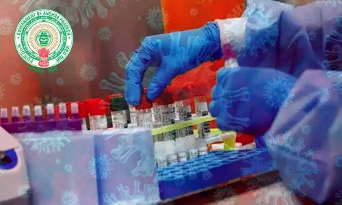 Andhra Pradesh govt. nods for private labs to conduct COVID-19 tests