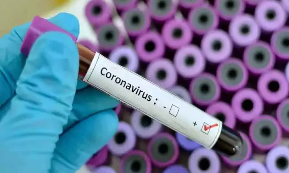 Hyderabad: Kondapur area hospital superintendent tests positive for coronavirus