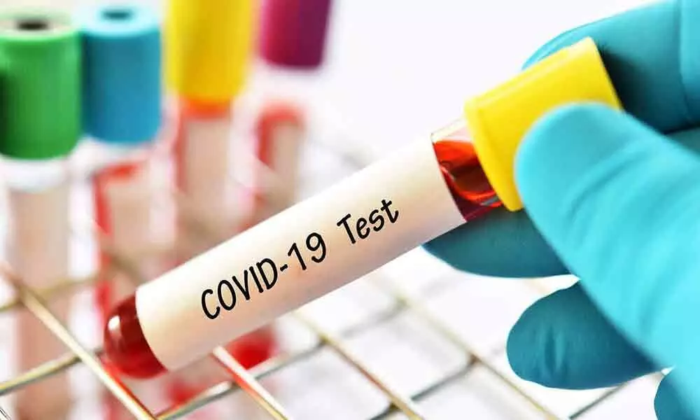 Telangana state government in catch-22 situation on Covid tests