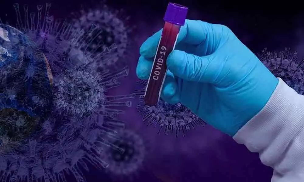 Andhra Pradesh  reports 193 new Coronavirus cases in state taking tally to 5280