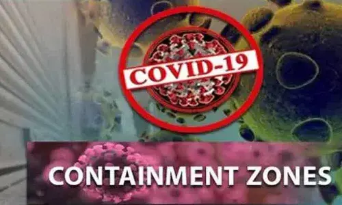 Representational Pic