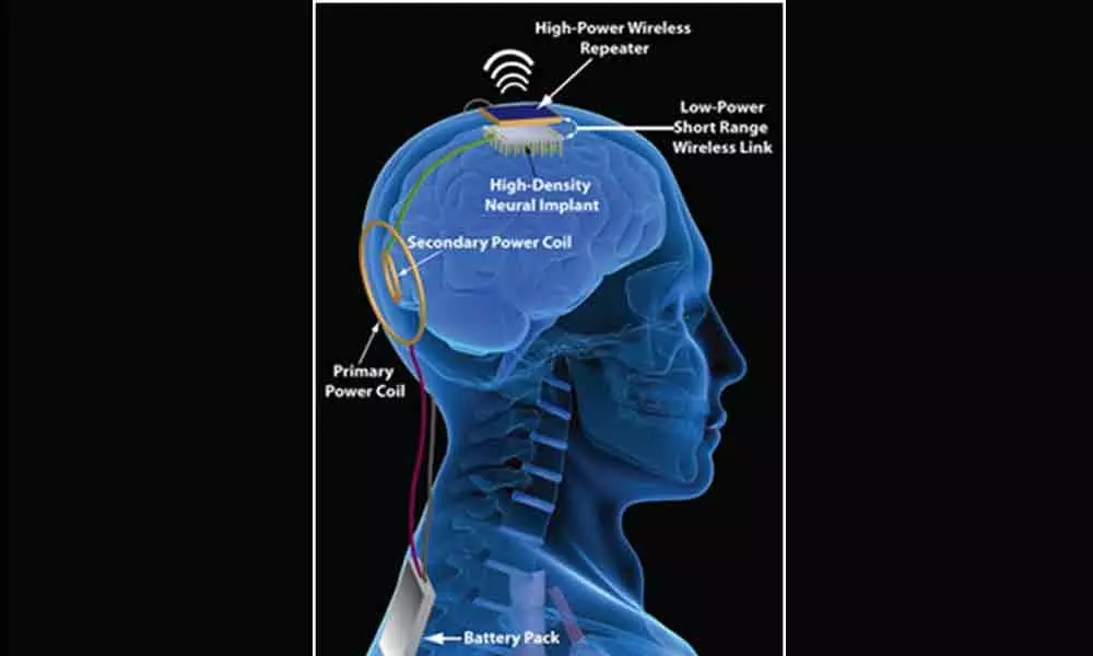 Birth and Mind Control Implant Chips: Are We On Our Way to Become Robotic Slaves?
