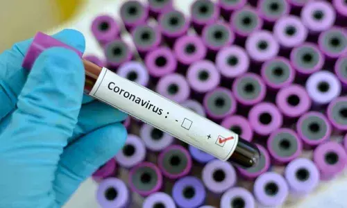 115 fresh Covid cases registered in Kadapa dist