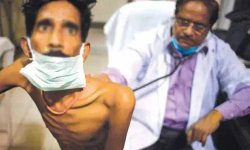 Karnataka: 35% of increase in non public sector TB cases in 2019