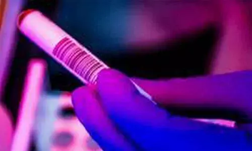 Hallmark immune system response in severe cases decoded