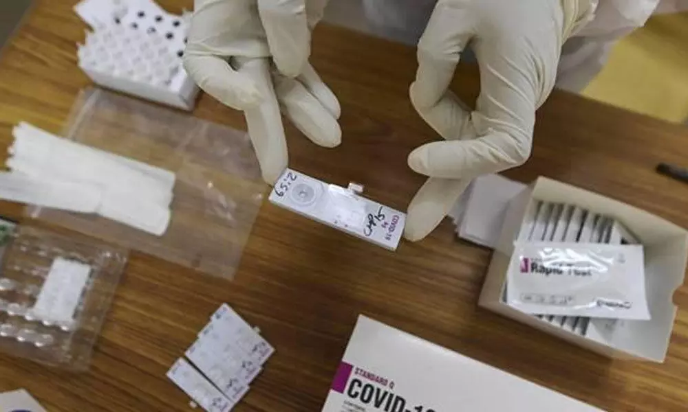 Coronavirus tests are expanded in the Hyderabad city and rapid Antigen tests