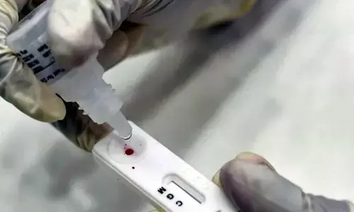 Too soon to say whether recovered COVID patients lose immunity with time: Scientists